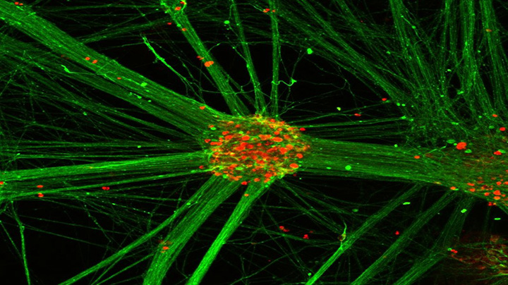 Microscope image of human pluripotent stem cell-derived motor neuron clusters.