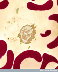 Image of white blood cells surrounded by red blood cells.